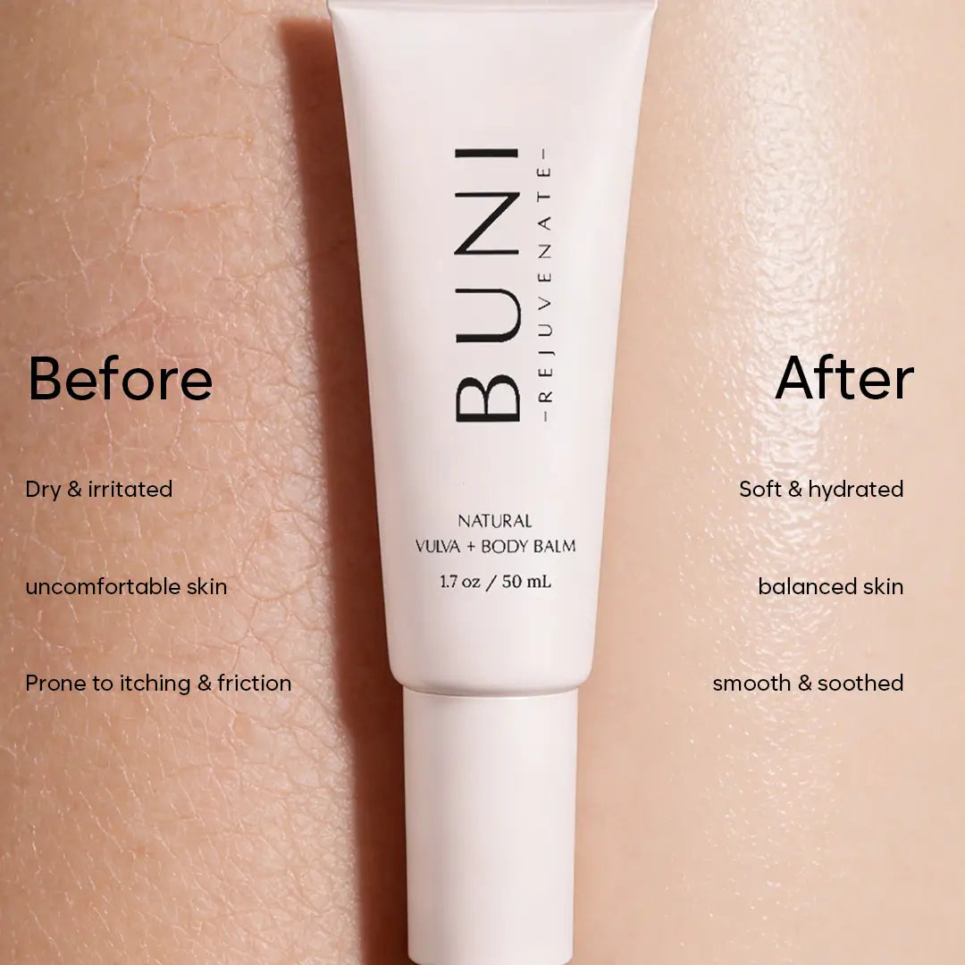 REJUVENATE: Vulva Balm