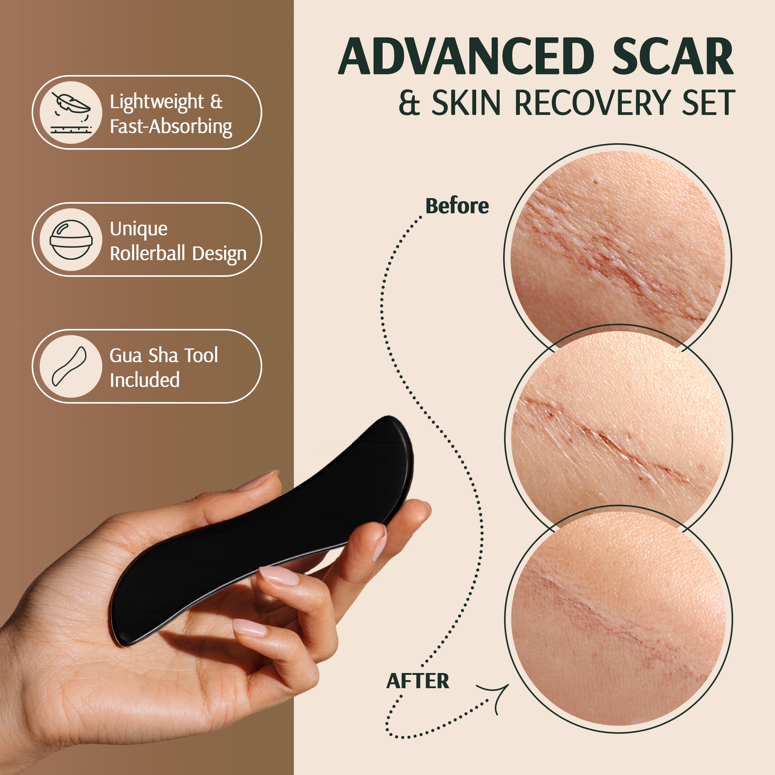 TRANSFORM: Scar+Body Treatment Oil